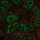Anti-NR0B1 antibody produced in rabbit Prestige Antibodies® Powered by Atlas Antibodies, affinity isolated antibody