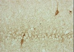 Anti-Glutamate Decarboxylase Antibody, 65 kDa isoform, clone GAD-6 clone GAD-6, Chemicon®, from mouse