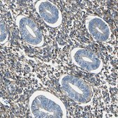 抗-COL3A1 兔抗 Prestige Antibodies® Powered by Atlas Antibodies, affinity isolated antibody, buffered aqueous glycerol solution