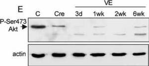 Anti-Actin, N-terminal antibody produced in rabbit ~0.5 mg/mL, affinity isolated antibody, buffered aqueous solution