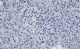 Anti-ACLY Antibody, clone 1B16 ZooMAb® Rabbit Monoclonal recombinant, expressed in HEK 293 cells