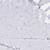 Anti-IL2RB antibody produced in rabbit Prestige Antibodies® Powered by Atlas Antibodies, affinity isolated antibody, buffered aqueous glycerol solution