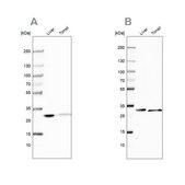 Anti-CA3 antibody produced in rabbit Prestige Antibodies® Powered by Atlas Antibodies, affinity isolated antibody, buffered aqueous glycerol solution, Ab1