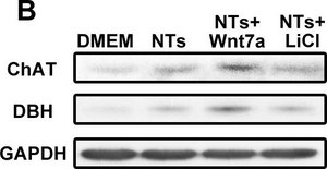 抗胆碱乙酰转移酶抗体，克隆1E6 ascites fluid, clone 1E6, Chemicon®