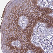 Anti-DSC3 antibody produced in rabbit Prestige Antibodies® Powered by Atlas Antibodies, affinity isolated antibody, buffered aqueous glycerol solution