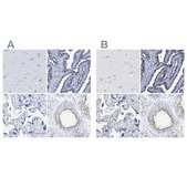 Anti-RSPH1 antibody produced in rabbit Prestige Antibodies® Powered by Atlas Antibodies, affinity isolated antibody, buffered aqueous glycerol solution