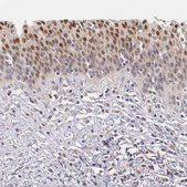 抗 ATF3 兔抗 Prestige Antibodies® Powered by Atlas Antibodies, affinity isolated antibody, buffered aqueous glycerol solution