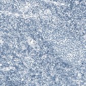 Monoclonal Anti-PRL antibody produced in mouse Prestige Antibodies® Powered by Atlas Antibodies, clone CL6559, purified immunoglobulin, buffered aqueous glycerol solution