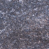 Monoclonal Anti-Pax5 Antibody Produced In Mouse Prestige Antibodies® Powered by Atlas Antibodies, clone CL14548, affinity isolated antibody, buffered aqueous glycerol solution