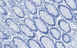 Anti-RAD21 Antibody, clone 2H12 ZooMAb® Rabbit Monoclonal recombinant, expressed in HEK 293 cells