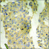 抗 磷酸-CaMK2 (pThr 286 ) 兔抗 affinity isolated antibody