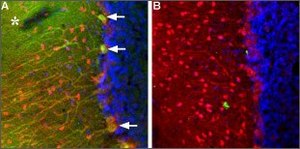 Anti-TRPC3 antibody produced in rabbit affinity isolated antibody, lyophilized powder