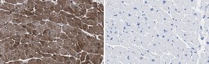 Anti-CACNA1C Antibody, clone 1F20 ZooMAb® Rabbit Monoclonal recombinant, expressed in HEK 293 cells