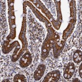 Anti-CYC1 antibody produced in rabbit Prestige Antibodies® Powered by Atlas Antibodies, affinity isolated antibody, buffered aqueous glycerol solution