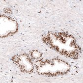 Monoclonal Anti-KLF4 antibody produced in mouse Prestige Antibodies® Powered by Atlas Antibodies, clone CL5782, purified immunoglobulin, buffered aqueous glycerol solution
