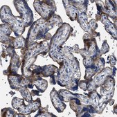 Anti-NEU1 antibody produced in rabbit Prestige Antibodies® Powered by Atlas Antibodies, affinity isolated antibody, buffered aqueous glycerol solution