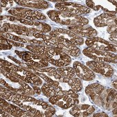 Anti-KRT8 antibody produced in rabbit Prestige Antibodies® Powered by Atlas Antibodies, affinity isolated antibody, buffered aqueous glycerol solution