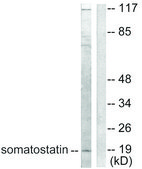 Anti-Somatostatin antibody produced in rabbit affinity isolated antibody