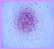 ES Cell Characterization Kit The Embryonic Stem Cell Characterization Kit phenotypically assesses the differentiation status of ES cells by measuring their AP activity, cell-surface stage-specific antigens (SSEA-1, SSEA-4) as well as expression of TRA-1-60, TRA-1-81 antigens.