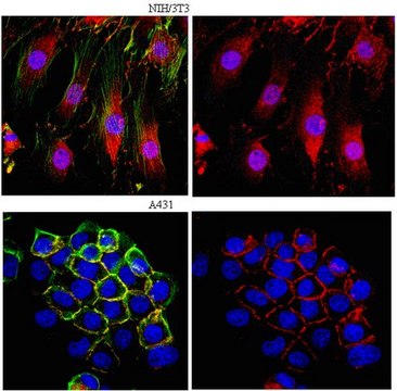 Anti-β-Catenin Antibody from rabbit, purified by affinity chromatography