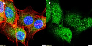 Anti-MLC-2 Antibody, clone 1B16 ZooMAb® Rabbit Monoclonal recombinant, expressed in HEK 293 cells