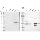 Anti-GCA antibody produced in rabbit Prestige Antibodies® Powered by Atlas Antibodies, affinity isolated antibody, buffered aqueous glycerol solution
