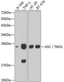 Anti-ASC/TMS1 antibody produced in rabbit