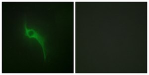 Anti-Collagen V α1 antibody produced in rabbit affinity isolated antibody
