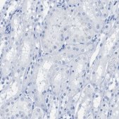 Anti-KCNA3 antibody produced in rabbit Prestige Antibodies® Powered by Atlas Antibodies, affinity isolated antibody, buffered aqueous glycerol solution