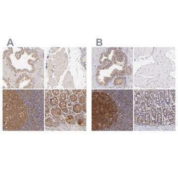 Anti-PRKCD antibody produced in rabbit Ab1, Prestige Antibodies® Powered by Atlas Antibodies, affinity isolated antibody, buffered aqueous glycerol solution