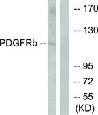 Anti-PDGF Receptor β antibody produced in rabbit affinity isolated antibody