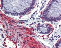 Anti-CREBBP antibody produced in rabbit affinity isolated antibody