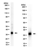 Anti-Calretinin from rabbit, purified by affinity chromatography