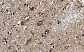 Anti-PKCα Antibody, clone 2H22 ZooMAb® Rabbit Monoclonal recombinant, expressed in HEK 293 cells