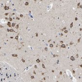 Anti-SRPK2 antibody produced in rabbit Prestige Antibodies® Powered by Atlas Antibodies, affinity isolated antibody, buffered aqueous glycerol solution