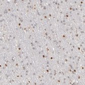 Anti-NFIB antibody produced in rabbit Prestige Antibodies® Powered by Atlas Antibodies, affinity isolated antibody, buffered aqueous glycerol solution