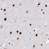 Monoclonal Anti-ADAR antibody produced in mouse Prestige Antibodies® Powered by Atlas Antibodies, clone CL0176, purified immunoglobulin, buffered aqueous glycerol solution