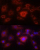 Anti-SOD2 antibody produced in rabbit