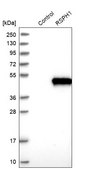 Anti-RSPH1 antibody produced in rabbit Prestige Antibodies® Powered by Atlas Antibodies, affinity isolated antibody, buffered aqueous glycerol solution