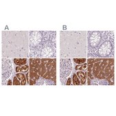 Anti-FTCD antibody produced in rabbit Prestige Antibodies® Powered by Atlas Antibodies, affinity isolated antibody, buffered aqueous glycerol solution