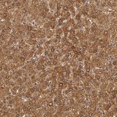 Anti-MPST antibody produced in rabbit Prestige Antibodies® Powered by Atlas Antibodies, affinity isolated antibody, buffered aqueous glycerol solution