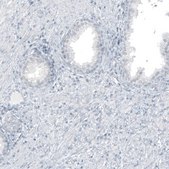 Monoclonal Anti-GLS2 antibody produced in mouse Prestige Antibodies® Powered by Atlas Antibodies, clone CL7716, purified immunoglobulin, buffered aqueous glycerol solution