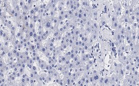 Anti-N-Cadherin Antibody, clone 3H17 ZooMAb® Rabbit Monoclonal recombinant, expressed in HEK 293 cells