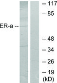 Anti-Estrogen Receptor-α antibody produced in rabbit affinity isolated antibody