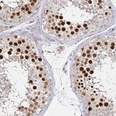 Anti-ANLN antibody produced in rabbit Prestige Antibodies® Powered by Atlas Antibodies, affinity isolated antibody, buffered aqueous glycerol solution