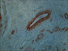 单克隆抗-胶原蛋白，IV型 小鼠抗 clone COL-94, ascites fluid