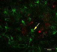 Anti-Amyloid Oligomer Antibody, αβ, oligomeric serum, Chemicon®