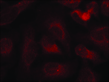 抗-磷酸化-ABL1/ABL2 (pTyr393/429) 兔抗 affinity isolated antibody