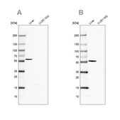 Anti-FTCD antibody produced in rabbit Prestige Antibodies® Powered by Atlas Antibodies, affinity isolated antibody, buffered aqueous glycerol solution
