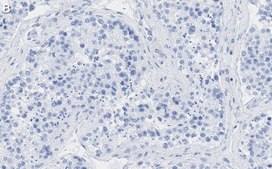 Anti-Calmodulin Antibody, clone 1G3 ZooMAb® Rabbit Monoclonal recombinant, expressed in HEK 293 cells